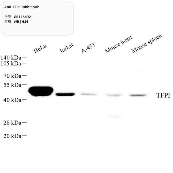 Антитела первичные, поликлональные, TFPI, 100 мкл