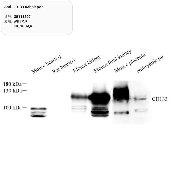 Антитела первичные, поликлональные, CD133, 100 мкл
