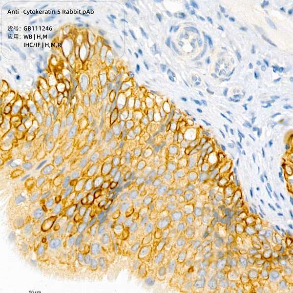 Антитела первичные, поликлональные, Cytokeratin 5, 100 мкл