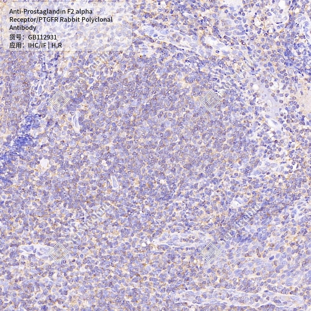 Антитела первичные, поликл. кролика к Prostaglandin F2 alpha Receptor/PTGFR крысы, чел., 100 мкл