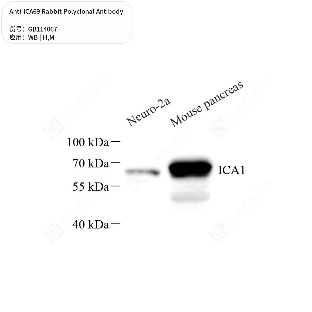 Антитела первичные, поликлональные кролика к ICA69 мыши, человека, 100 мкл
