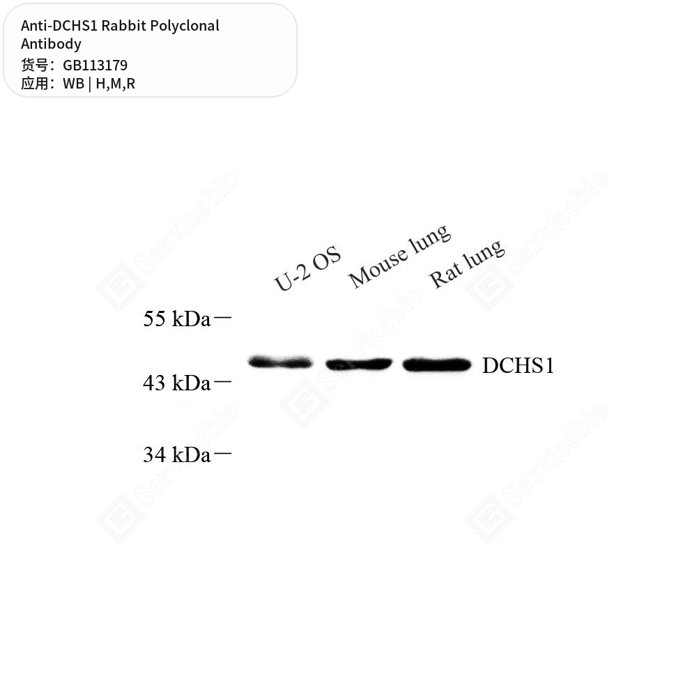Антитела первичные, поликлональные кролика к DCHS1 крысы, мыши, человека, 100 мкл