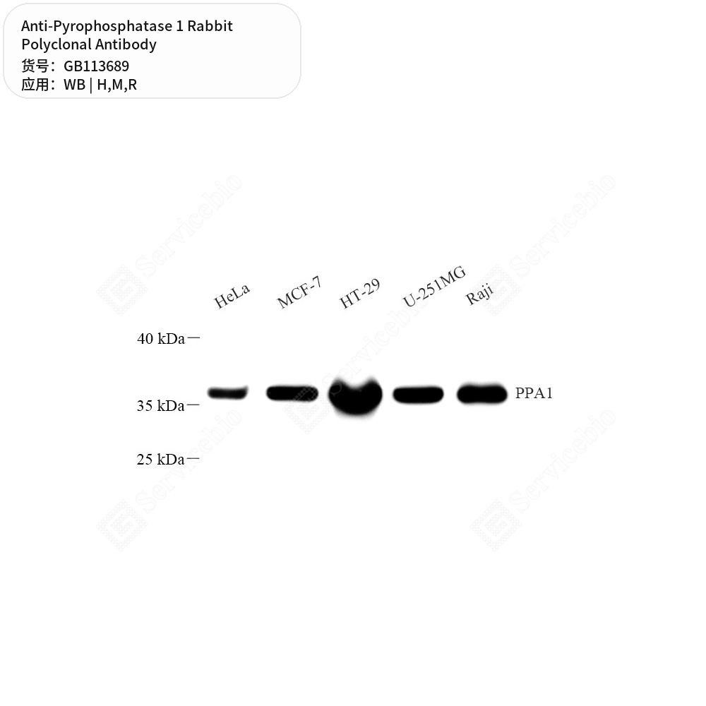 Антитела первичные, поликлональные кролика к Pyrophosphatase 1 крысы, мыши, человека, 100 мкл