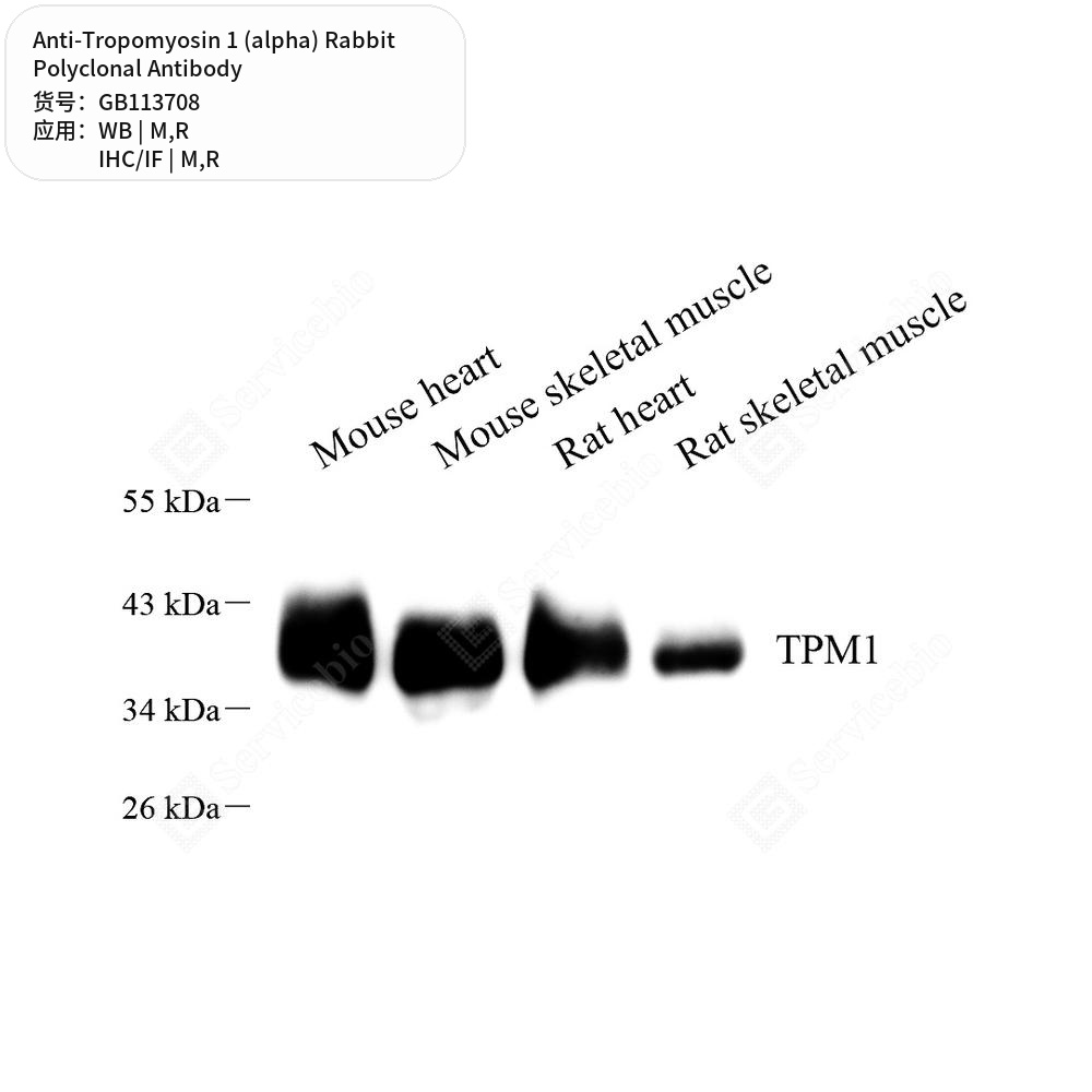 Антитела первичные, поликлональные кролика к Tropomyosin 1 (alpha) крысы, мыши, 50 мкл