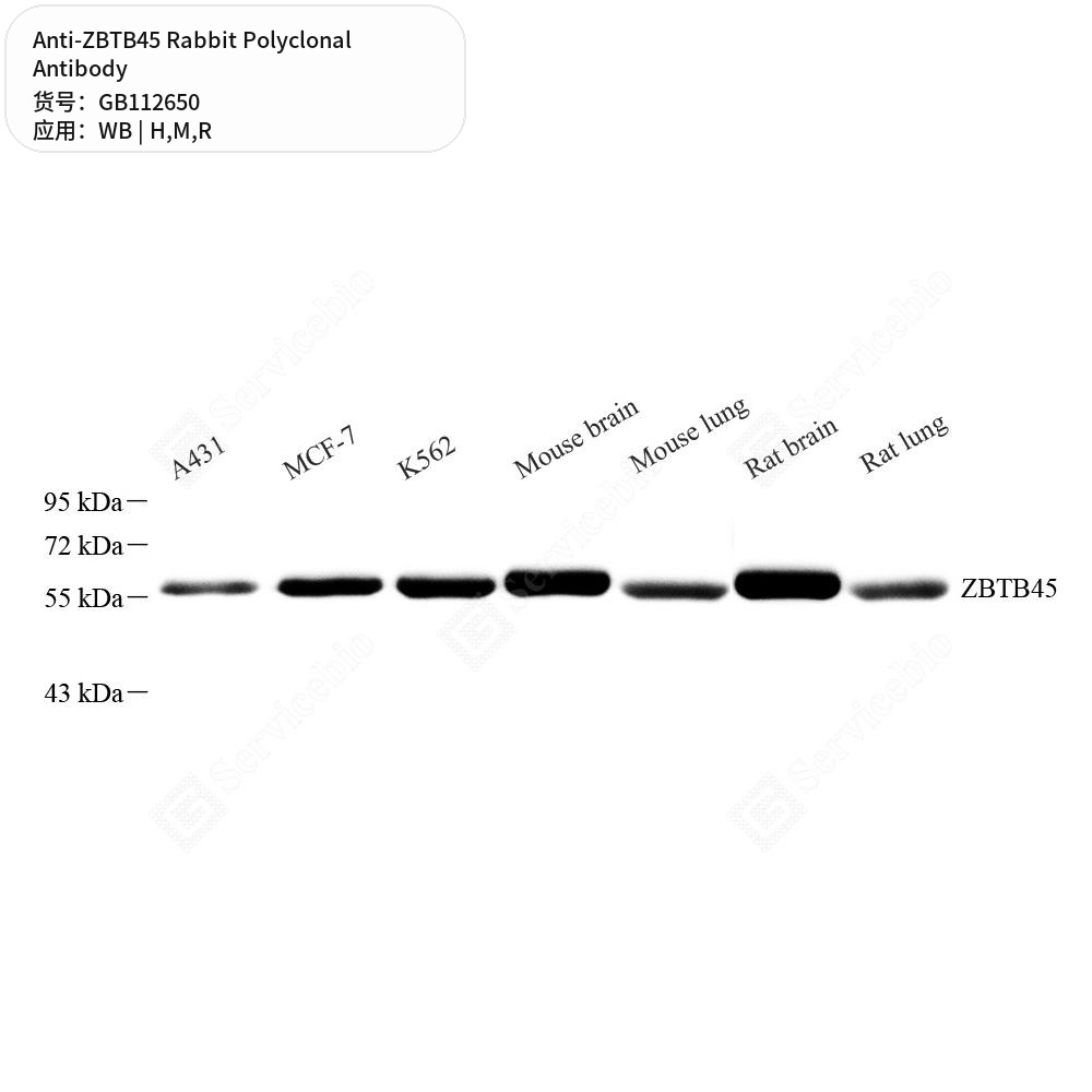 Антитела первичные, поликлональные кролика к ZBTB45 крысы, мыши, человека, 100 мкл
