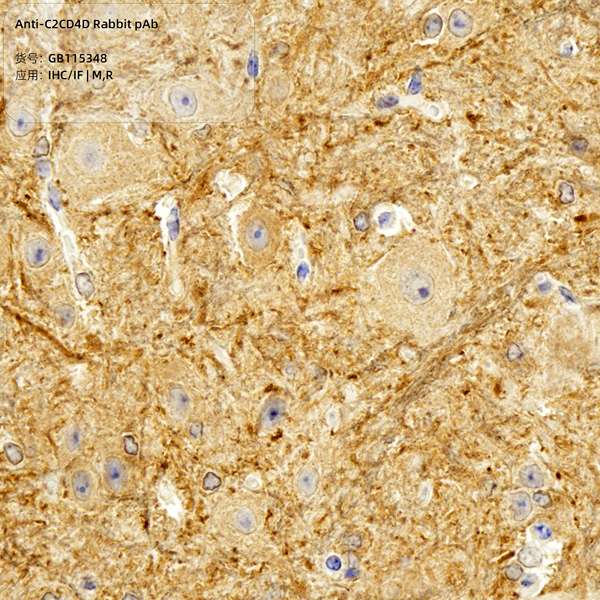 Антитела первичные, поликлональные, C2CD4D, 100 мкл