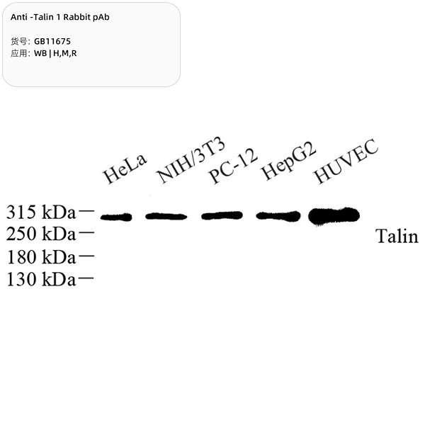 Антитела первичные, поликлональные, Talin 1, 100 мкл