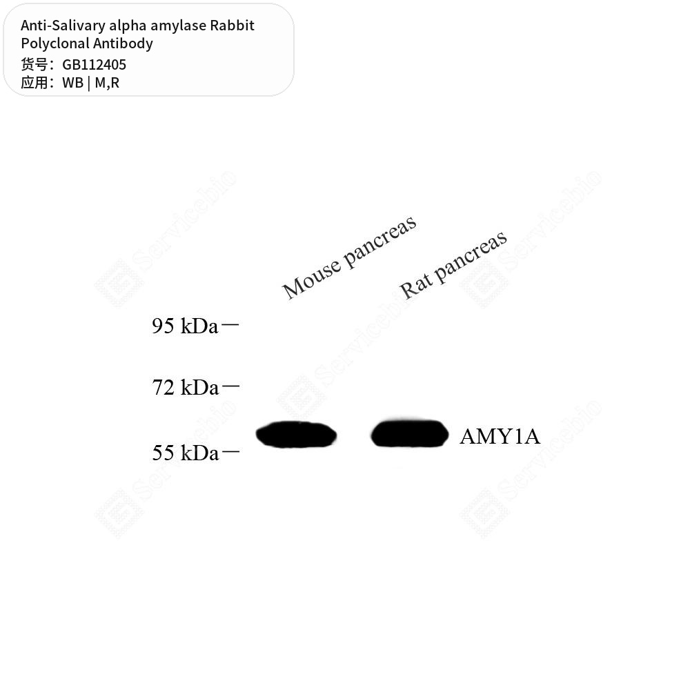 Антитела первичные, поликлональные кролика к Salivary alpha amylase крысы, мыши, 100 мкл