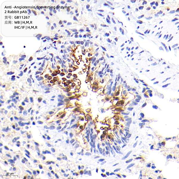 Антитела первичные, поликлональные, Angiotensin Converting Enzyme 2, 50 мкл