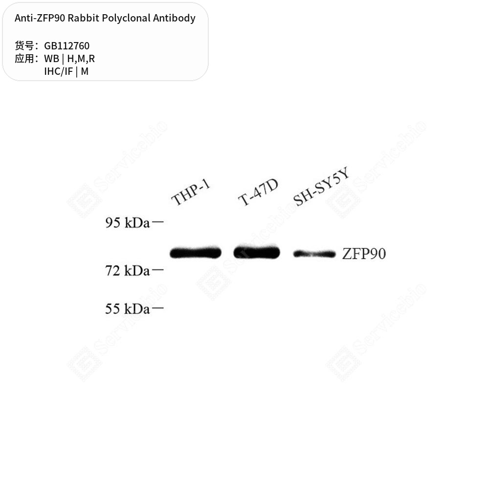 Антитела первичные, поликлональные кролика к ZFP90 крысы, мыши, человека, 100 мкл