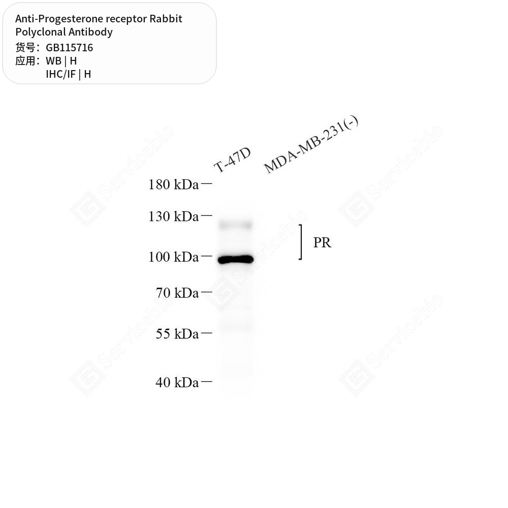 Антитела первичные, поликлональные кролика к Progesterone receptor человека, 50 мкл