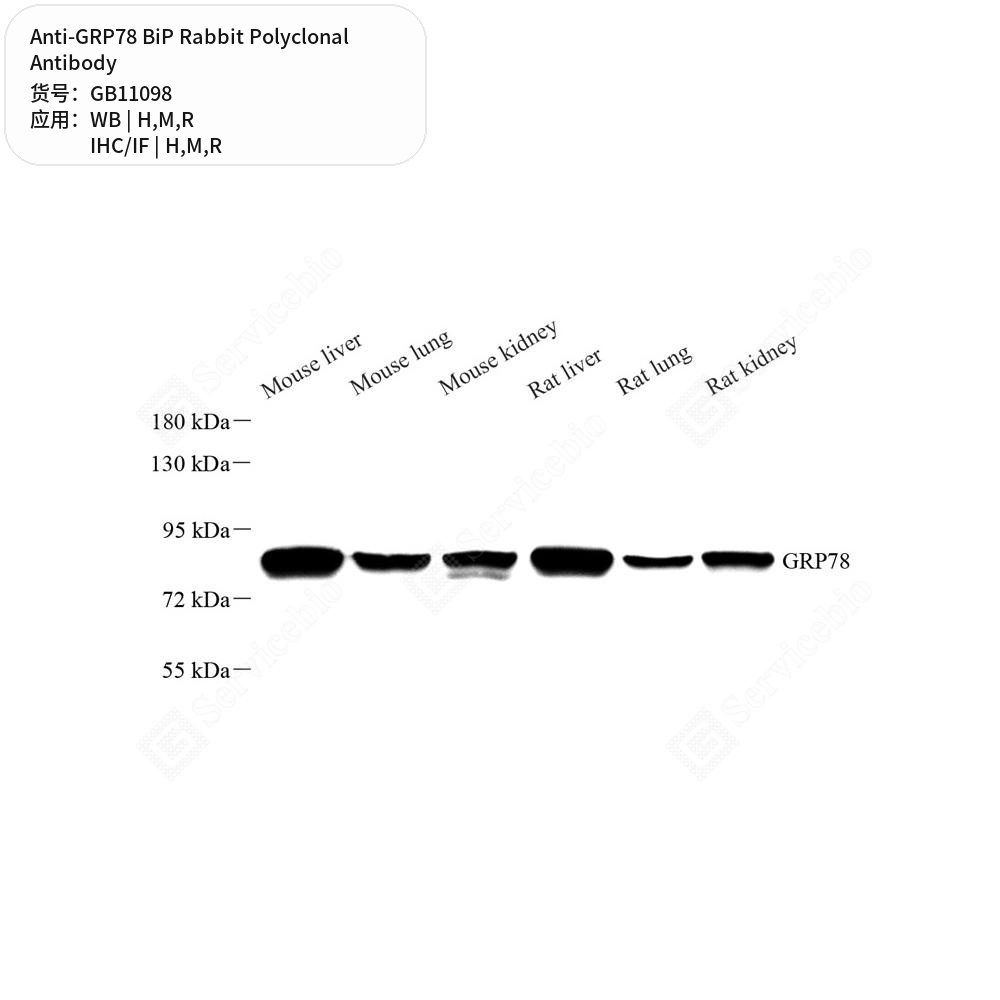 Антитела первичные, поликлональные кролика к GRP78 BiP крысы, мыши, человека, 100 мкл