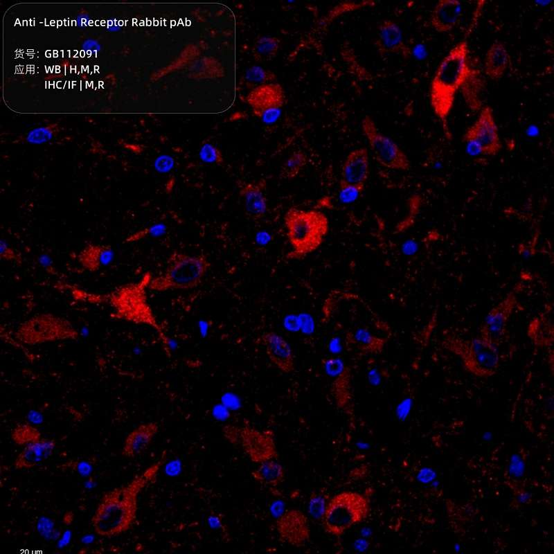 Антитела первичные, поликлональные, Leptin Receptor, 100 мкл