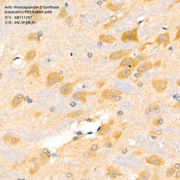 Антитела первичные, поликл. кролика к Prostaglandin D Synthase (Lipocalin)/PDS крысы, мыши, 100 мкл