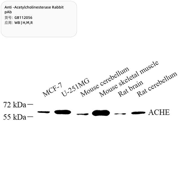 Антитела первичные, поликлональные, Acetylcholinesterase, 100 мкл