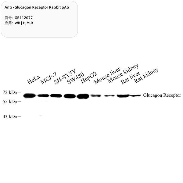 Антитела первичные, поликлональные, Glucagon Receptor, 100 мкл