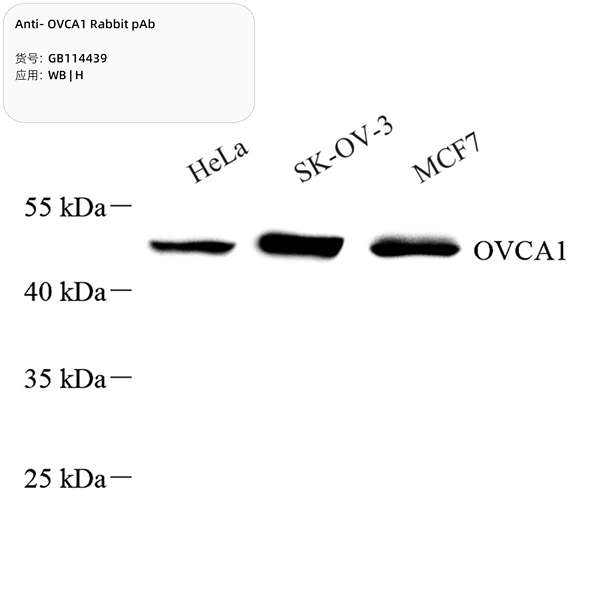 Антитела первичные, поликлональные, OVCA1, 100 мкл