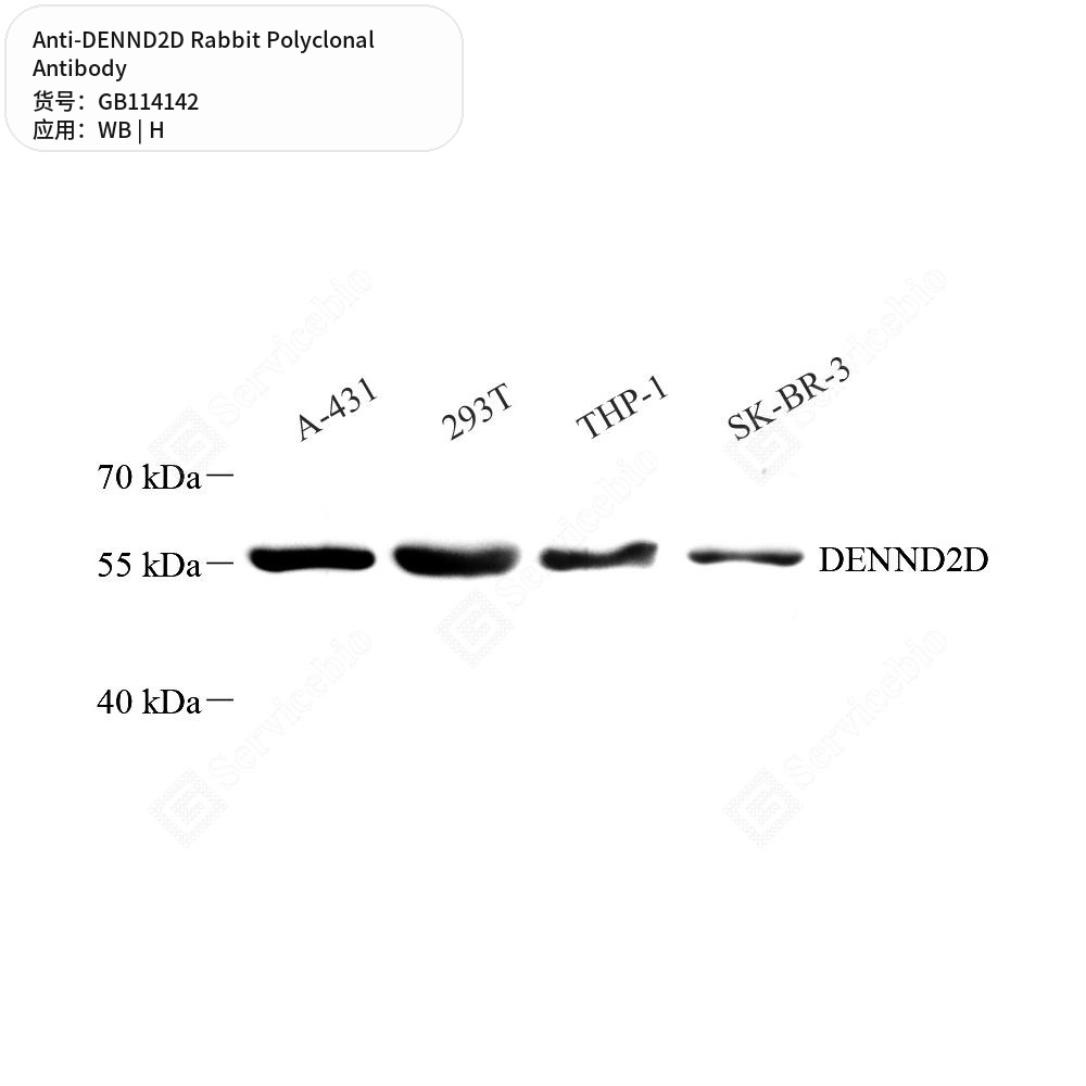 Антитела первичные, поликлональные кролика к DENND2D человека, 100 мкл