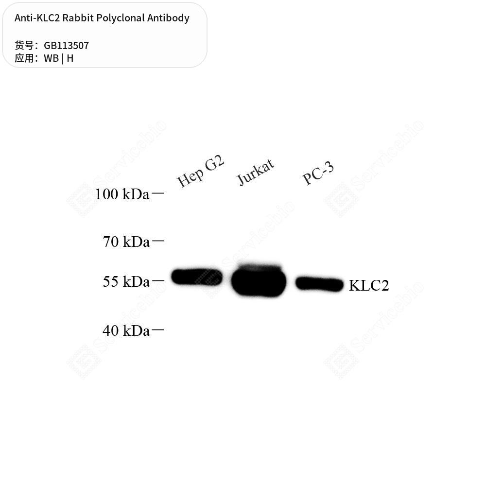 Антитела первичные, поликлональные кролика к KLC2 человека, 50 мкл