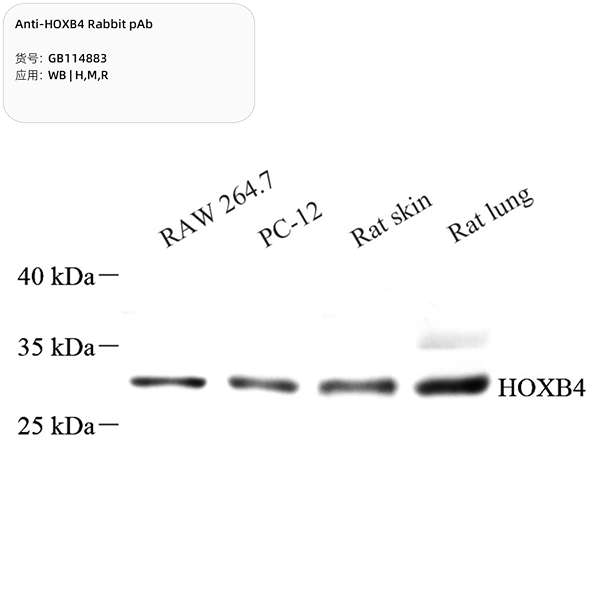 Антитела первичные, поликлональные, HOXB4, 100 мкл