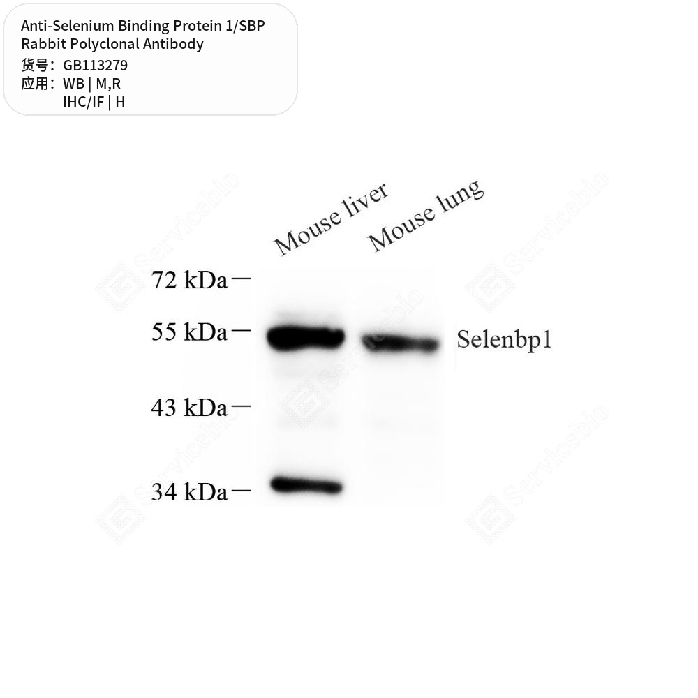 Антитела первичные, поликл. кролика к Selenium Binding Protein 1/SBP крысы, мыши, человека, 100 мкл