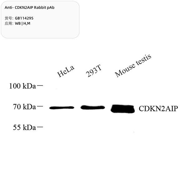Антитела первичные, поликлональные, CDKN2AIP, 100 мкл