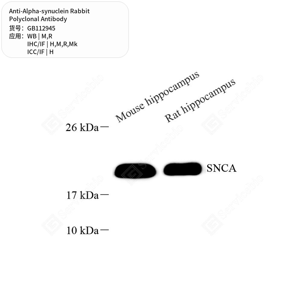 Антитела первичные, поликл. кролика к Alpha-synuclein крысы, мыши, обезьяны, человека, 50 мкл