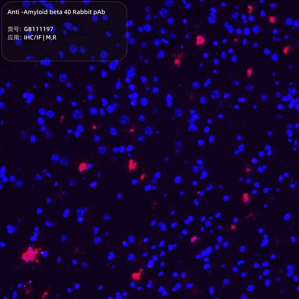 Антитела первичные, поликлональные, Amyloid beta 40, 100 мкл
