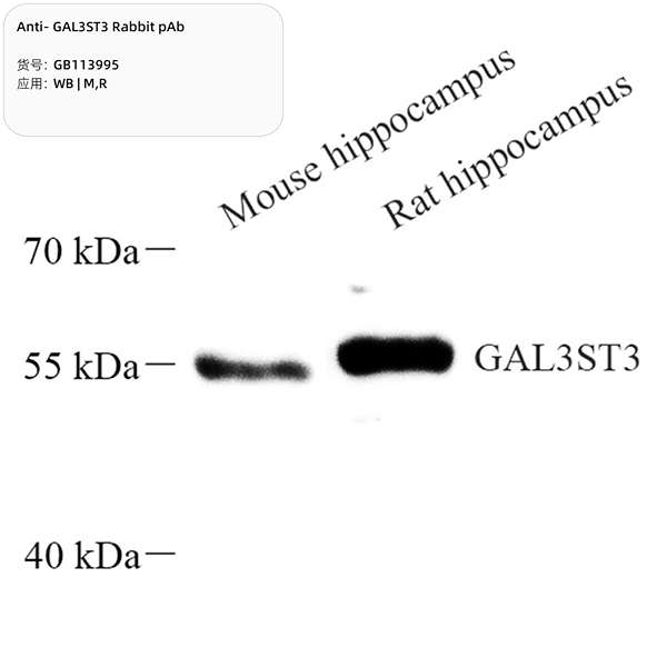 Антитела первичные, поликлональные, GAL3ST3, 100 мкл