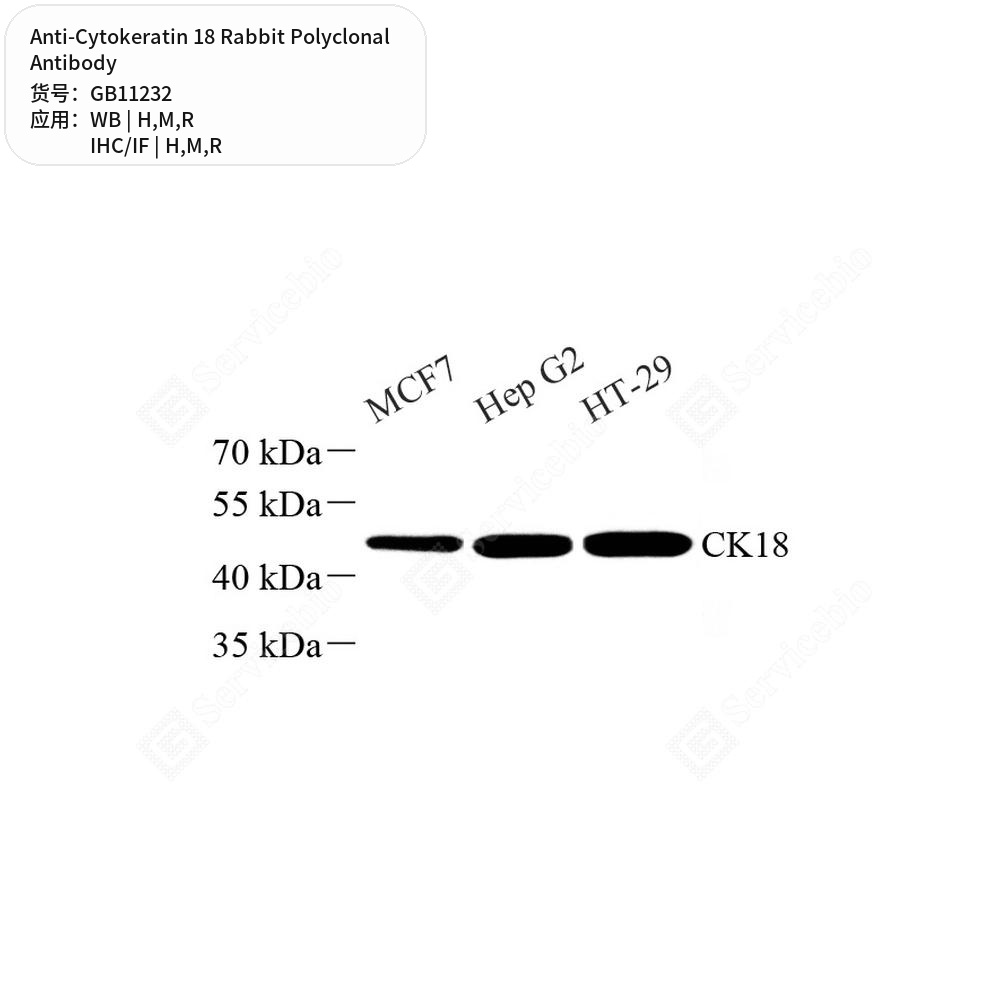 Антитела первичные, поликлональные кролика к Cytokeratin 18 крысы, мыши, человека, 100 мкл