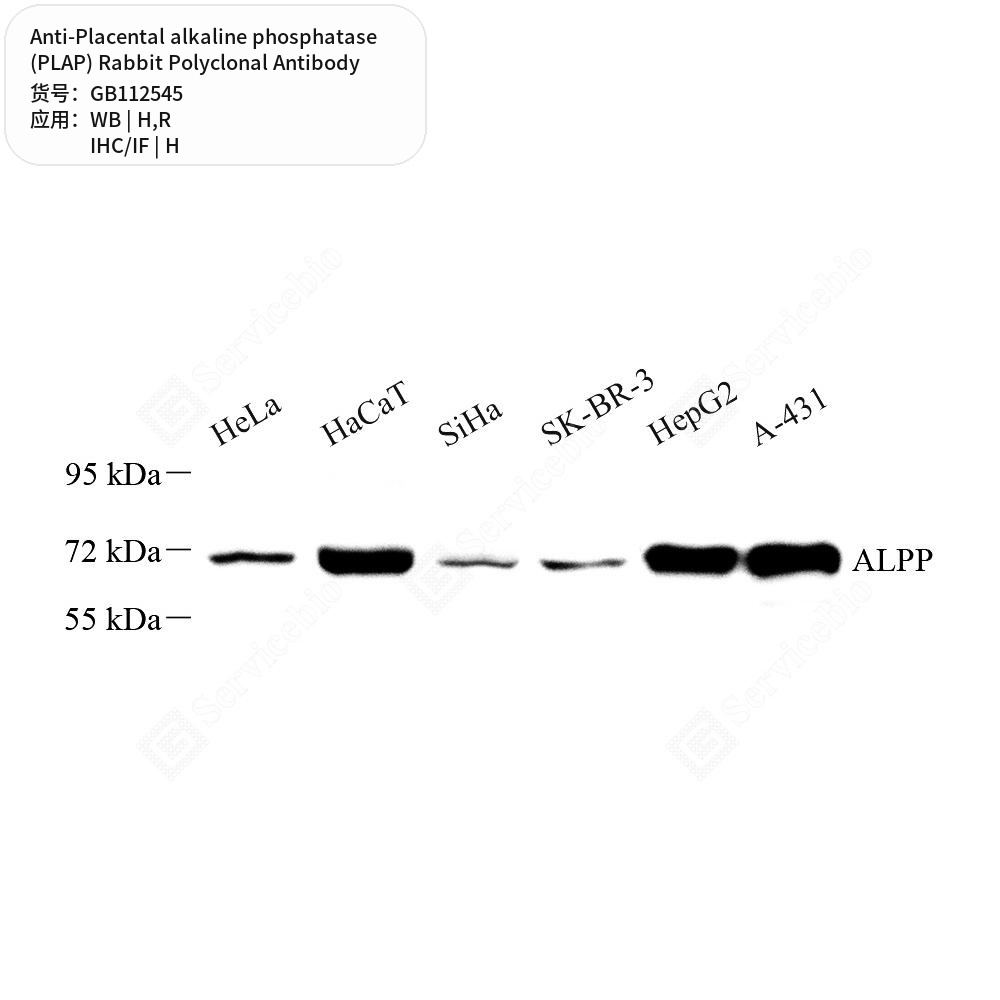 Антитела первичные, поликл. кролика к Placental alkaline phosphatase (PLAP) крысы, чел., 100 мкл
