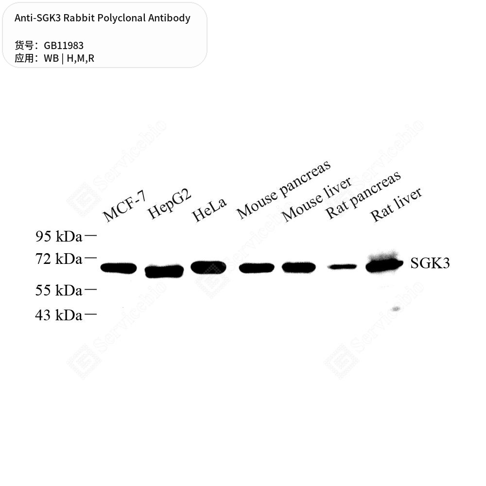 Антитела первичные, поликлональные кролика к SGK3 крысы, мыши, человека, 50 мкл
