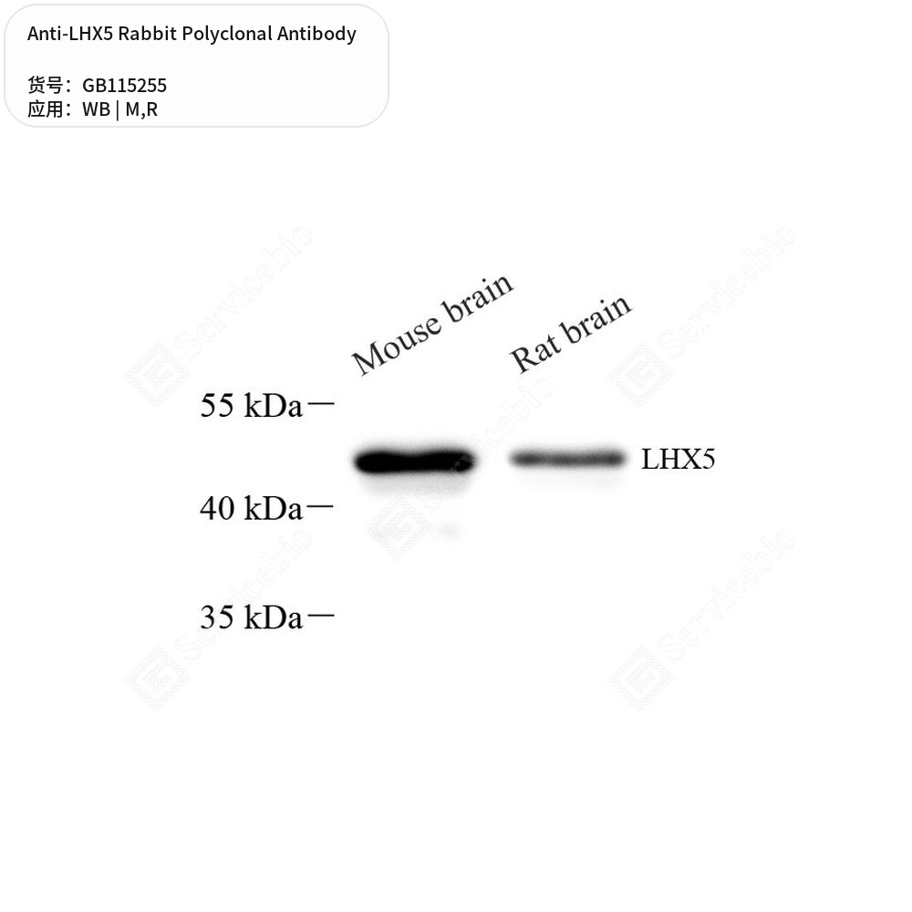 Антитела первичные, поликлональные кролика к LHX5 крысы, мыши, 50 мкл