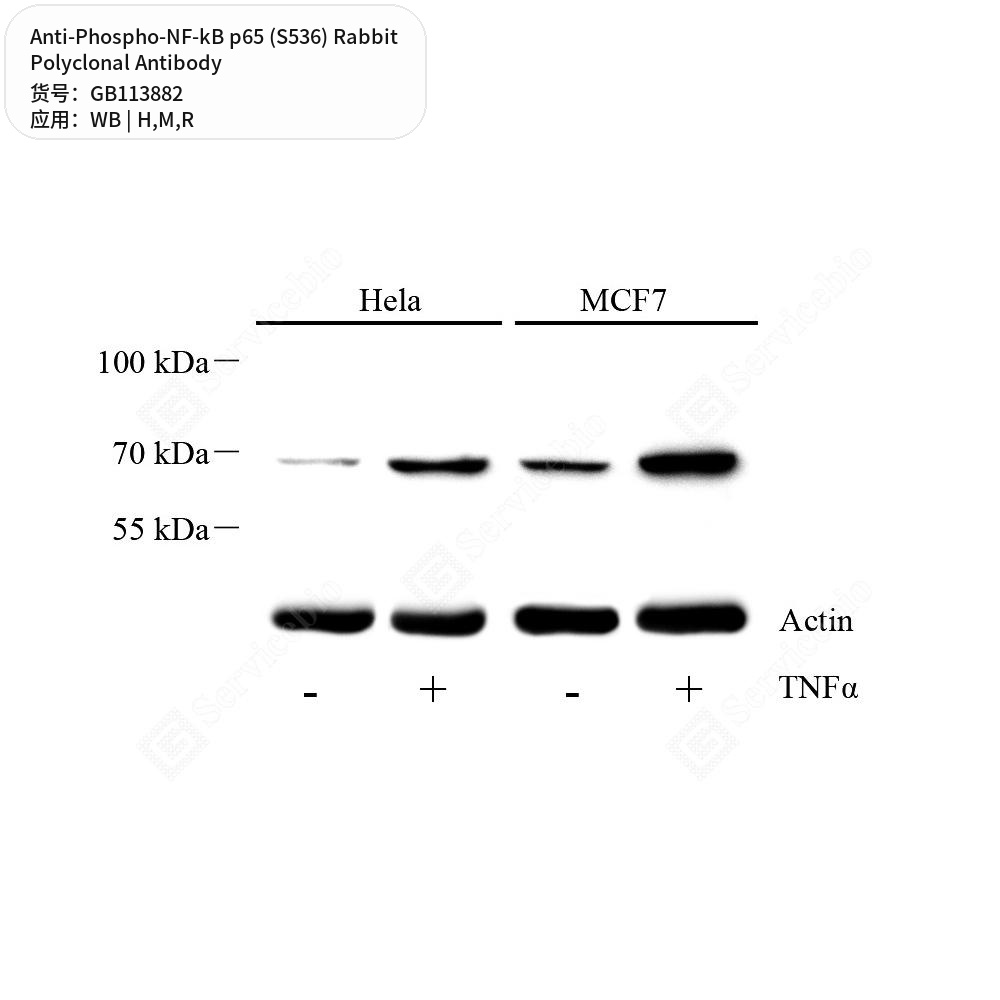 Антитела первичные, поликлональные кролика к Phospho-NF-kB p65 (S536) крысы, мыши, человека, 50 мкл