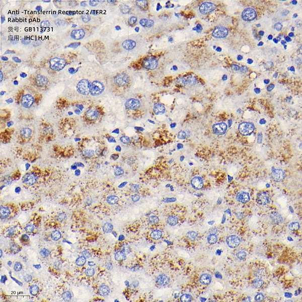 Антитела первичные, поликлональные, Transferrin Receptor 2/TFR2, 100 мкл