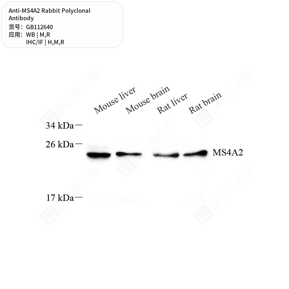 Антитела первичные, поликлональные кролика к MS4A2 крысы, мыши, человека, 100 мкл