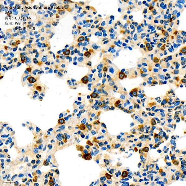 Антитела первичные, поликлональные, Fatty Acid Synthase, 100 мкл