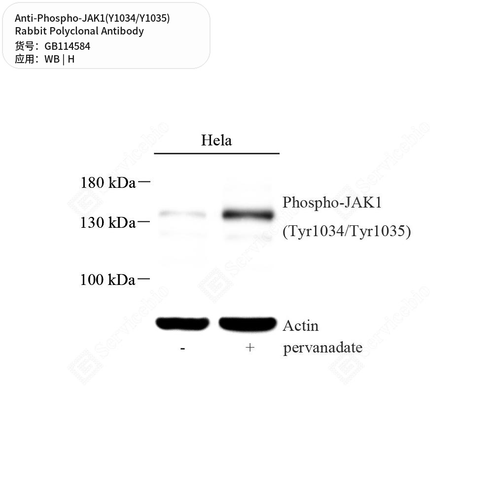 Антитела первичные, поликлональные кролика к Phospho-JAK1(Y1034/Y1035) человека, 100 мкл