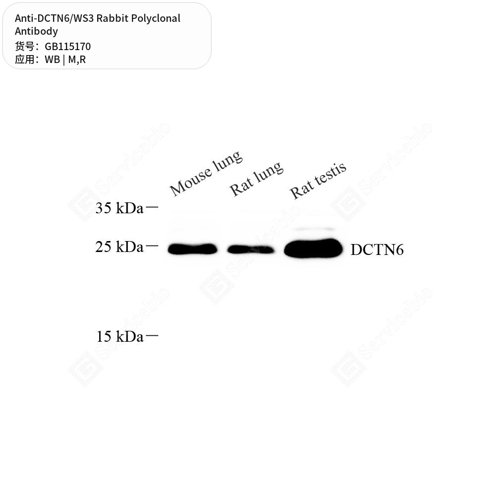 Антитела первичные, поликлональные кролика к DCTN6/WS3 крысы, мыши, 100 мкл