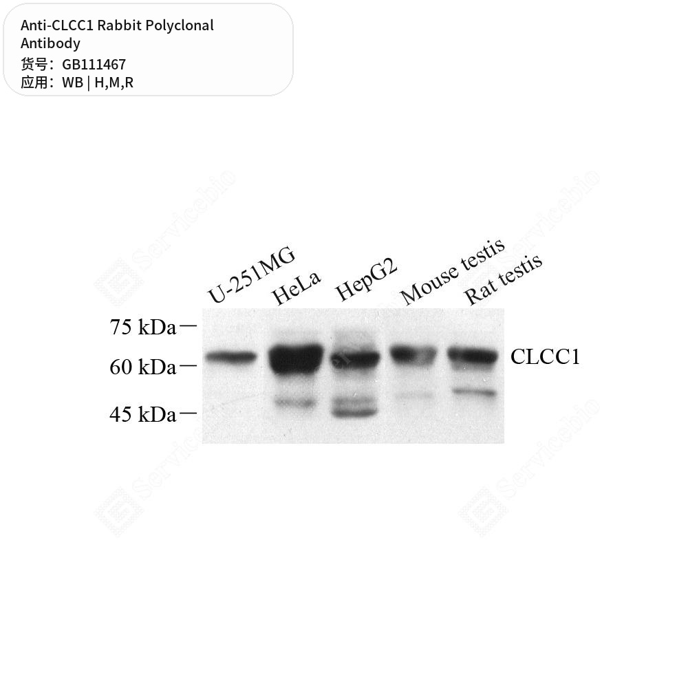 Антитела первичные, поликлональные кролика к CLCC1 крысы, мыши, человека, 100 мкл