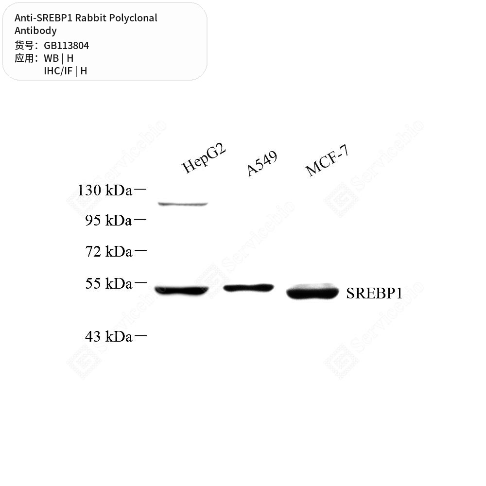 Антитела первичные, поликлональные кролика к SREBP1 человека, 100 мкл