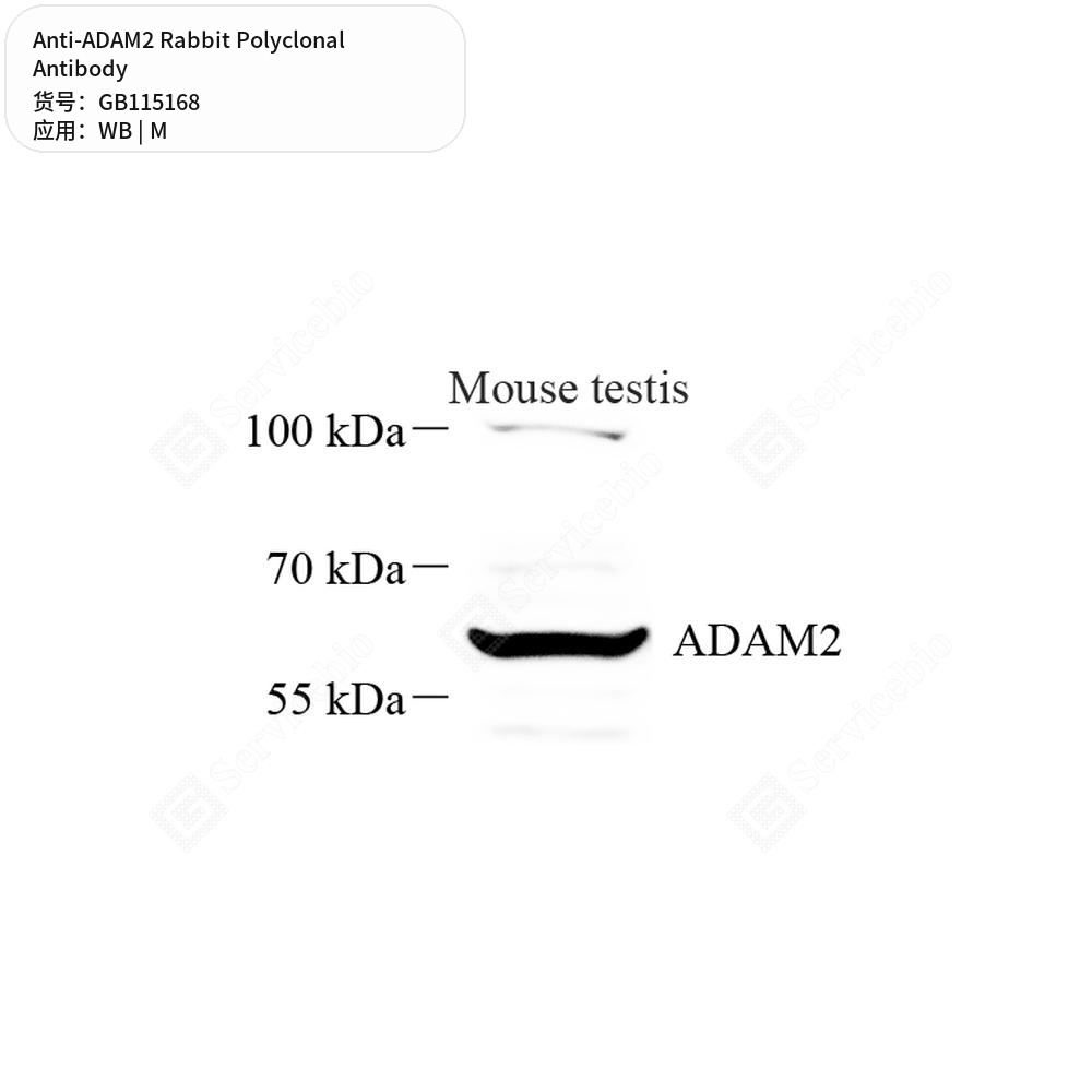 Антитела первичные, поликлональные кролика к ADAM2 мыши, 100 мкл