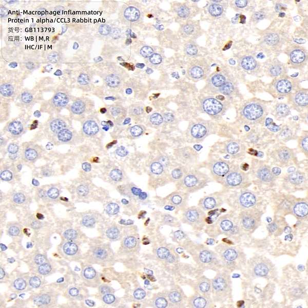Антитела первичные, поликлональные, Macrophage Inflammatory Protein 1 alpha/CCL3, 100 мкл