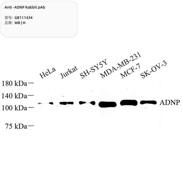 Антитела первичные, поликлональные, ADNP, 100 мкл