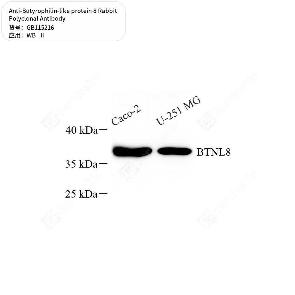 Антитела первичные, поликлональные кролика к Butyrophilin-like protein 8 человека, 50 мкл