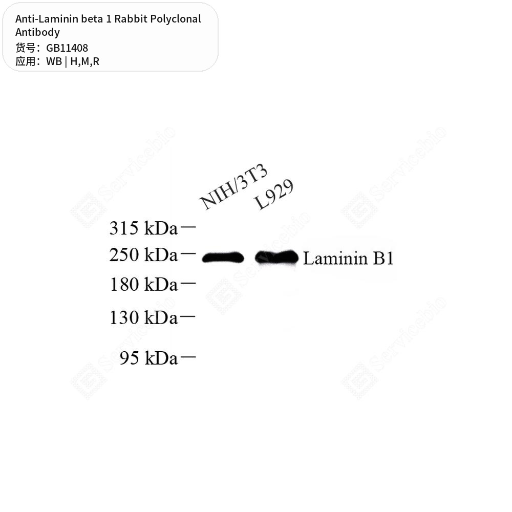 Антитела первичные, поликлональные кролика к Laminin beta 1 крысы, мыши, человека, 50 мкл