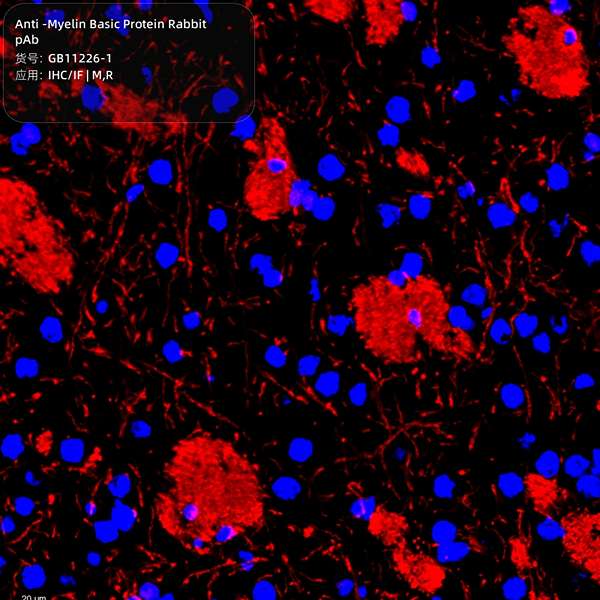 Антитела первичные, поликлональные, Myelin Basic Protein, 100 мкл
