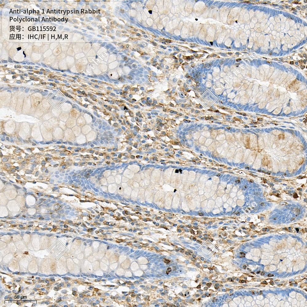 Антитела первичные, поликлональные кролика к alpha 1 Antitrypsin крысы, мыши, человека, 100 мкл
