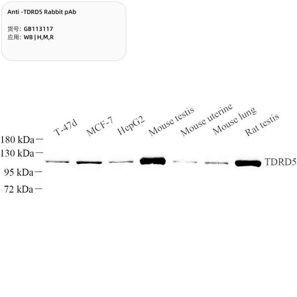 Антитела первичные, поликлональные, TDRD5, 100 мкл