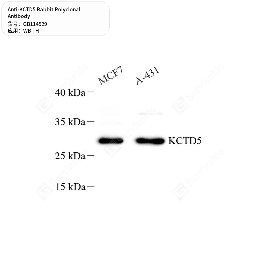Антитела первичные, поликлональные кролика к KCTD5 человека, 50 мкл